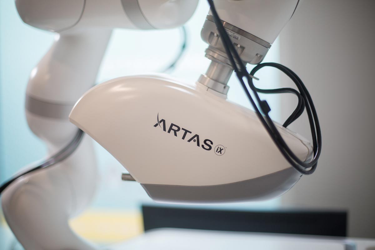 trasplante capilar con robot ARTA iX